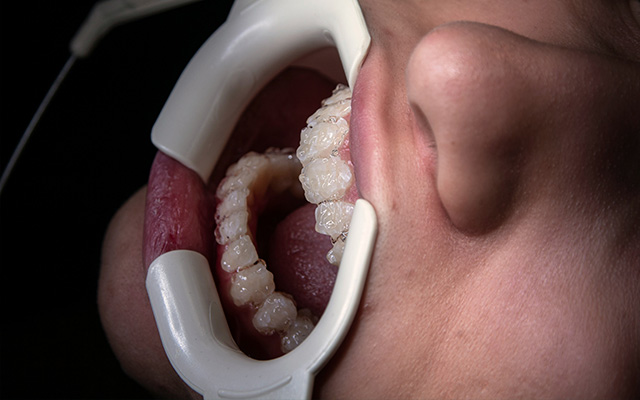 endodonzia